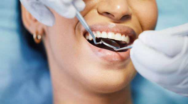 Best Emergency Dental Care for Sports Injuries in Yeagertown, PA